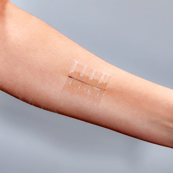 Emergency Wound Laceration Kit | 8 Pcs