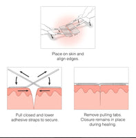 Emergency Wound Laceration Kit | 8 Pcs